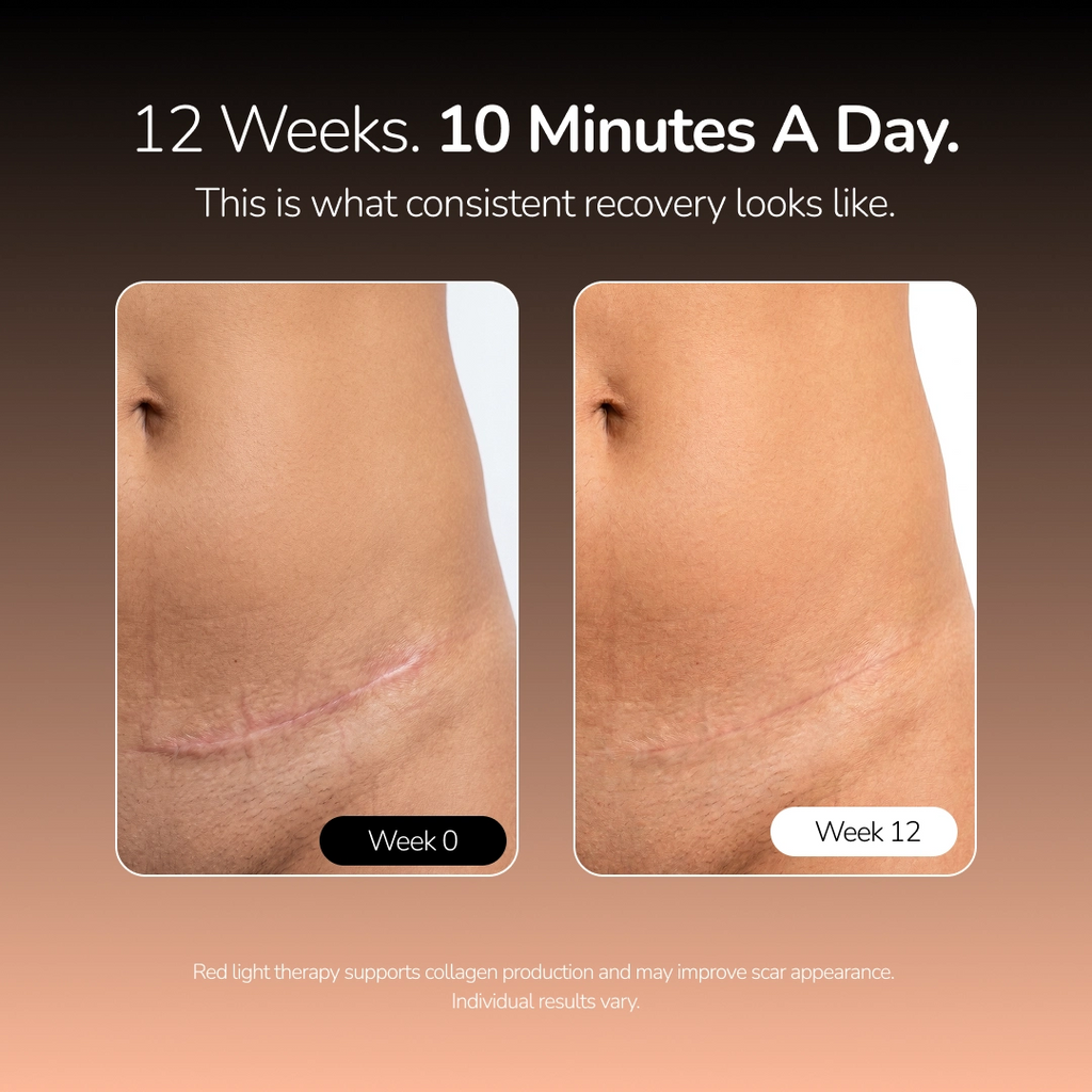 MaiaNuva Postpartum Red Light Recovery Belt