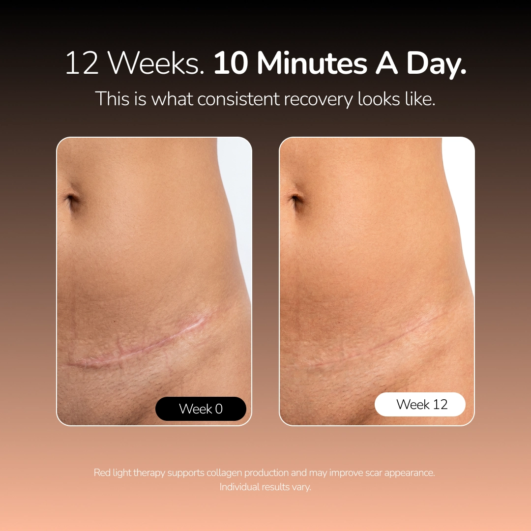 MaiaNuva Postpartum Red Light Recovery Belt